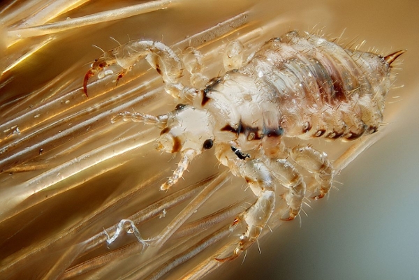 Photo of a Head Louse