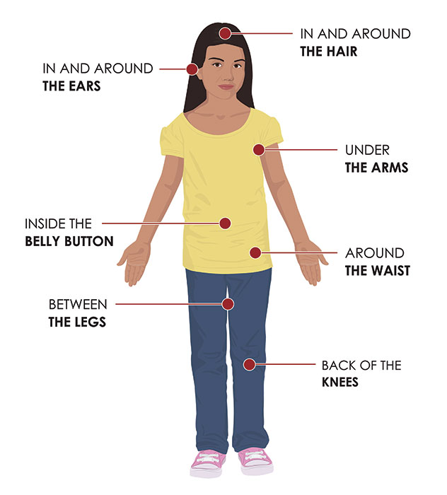 Labels point to areas on the body to check for ticks: In and around the hair, in and around the ears, under the arms, inside the belly button, around the waist, between the legs, back of the knees.