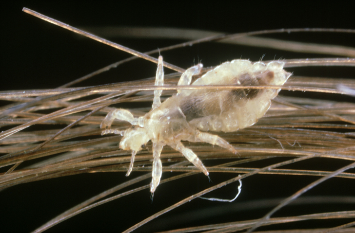 A close-up, magnified image of head lice