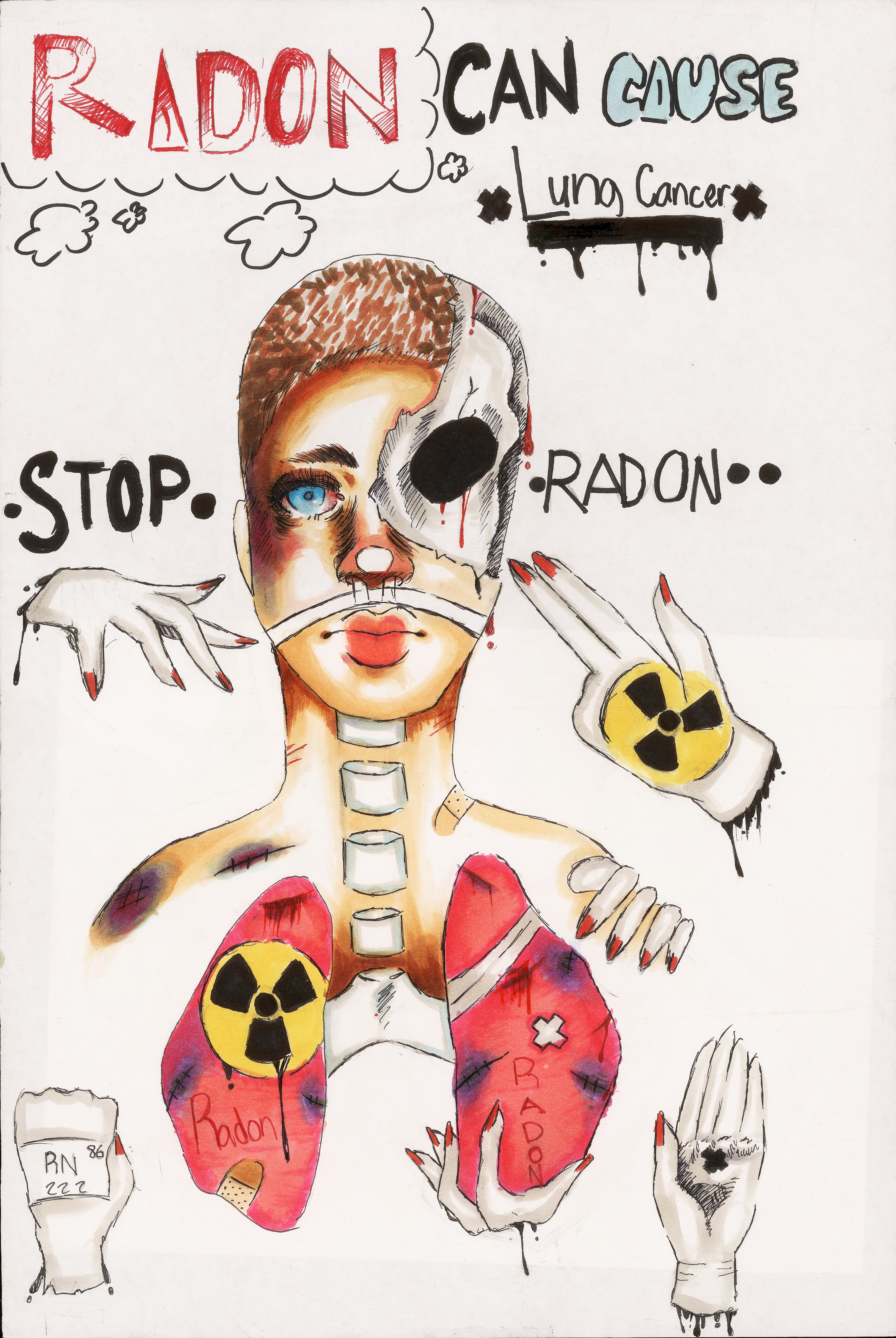 4 STPETER C VILATO RADON KILLS HIGHRES