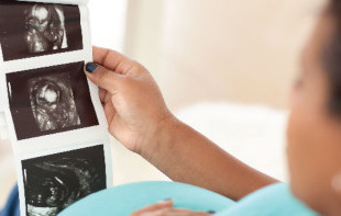 A person with dark skin holds up a strip of three black and white ultrasound images, looking at them.
